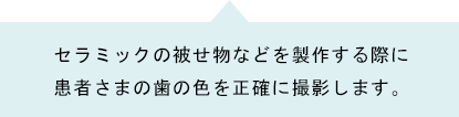 セラミックの被せ物などを製作する際に患者さまの歯の色を正確に撮影します。