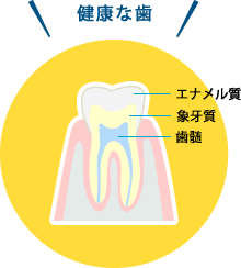 健康な歯