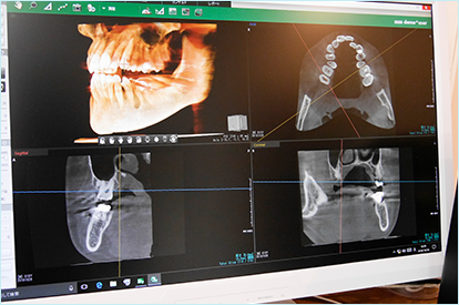 歯科用CT