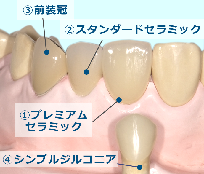 サンプル模型の比較